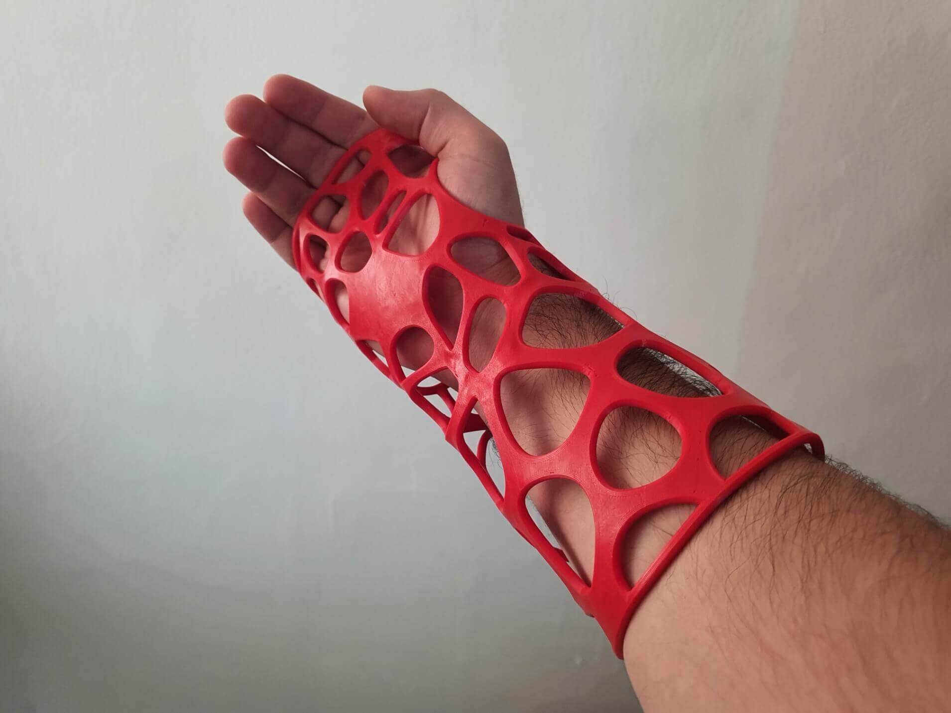 Férula impresa en 3D